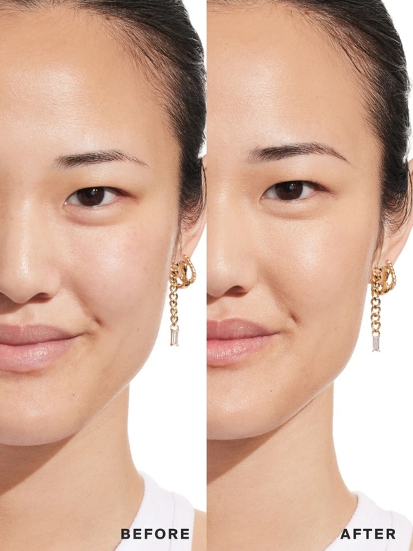 Clinical Before & After Dewy Skin Results